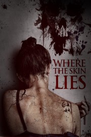 hd-Where the Skin Lies