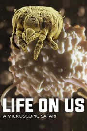 hd-Life on Us: A Microscopic Safari
